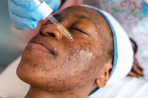 Dermatology